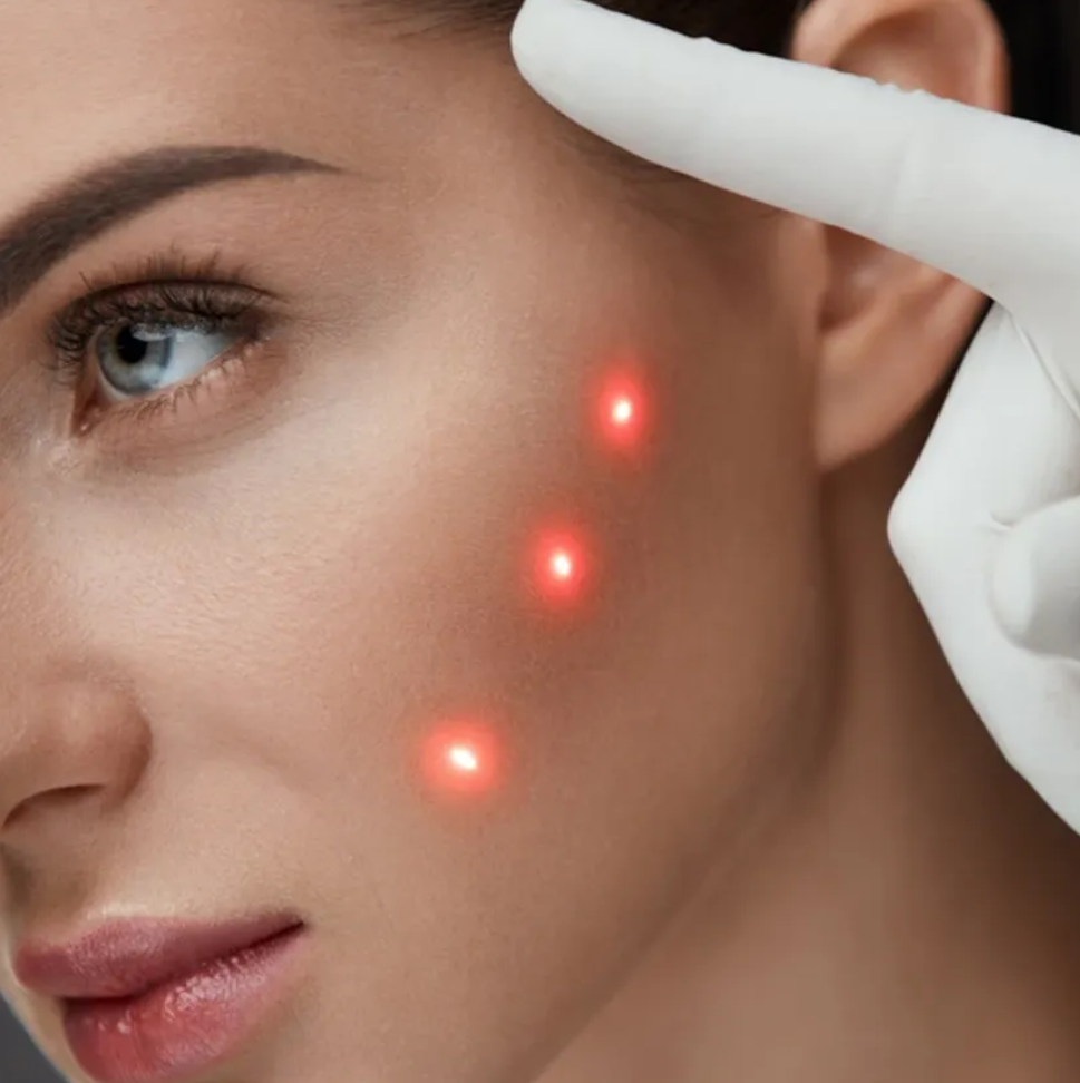 AdvaTX Laser Skin Health Treatment System